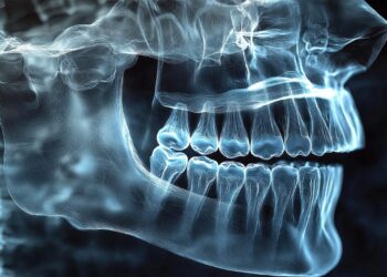 A detailed, glowing blue X-ray image of a human skull in profile, clearly showing the teeth, jawbone, and nasal cavity—highlighting bone loss in the jaw—with defined outlines against a dark background.