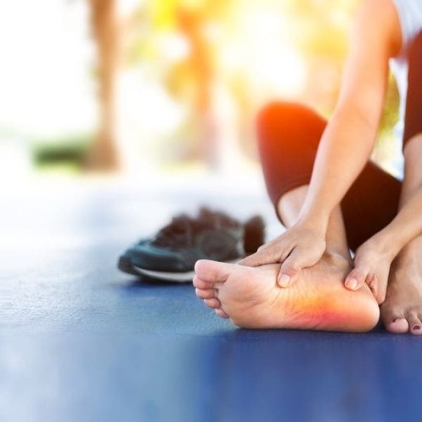 Woman Rubbing Heel with Visible Inflammation Woman sitting outdoors rubbing her inflamed heel, showing signs of plantar fasciitis pain after exercise.
